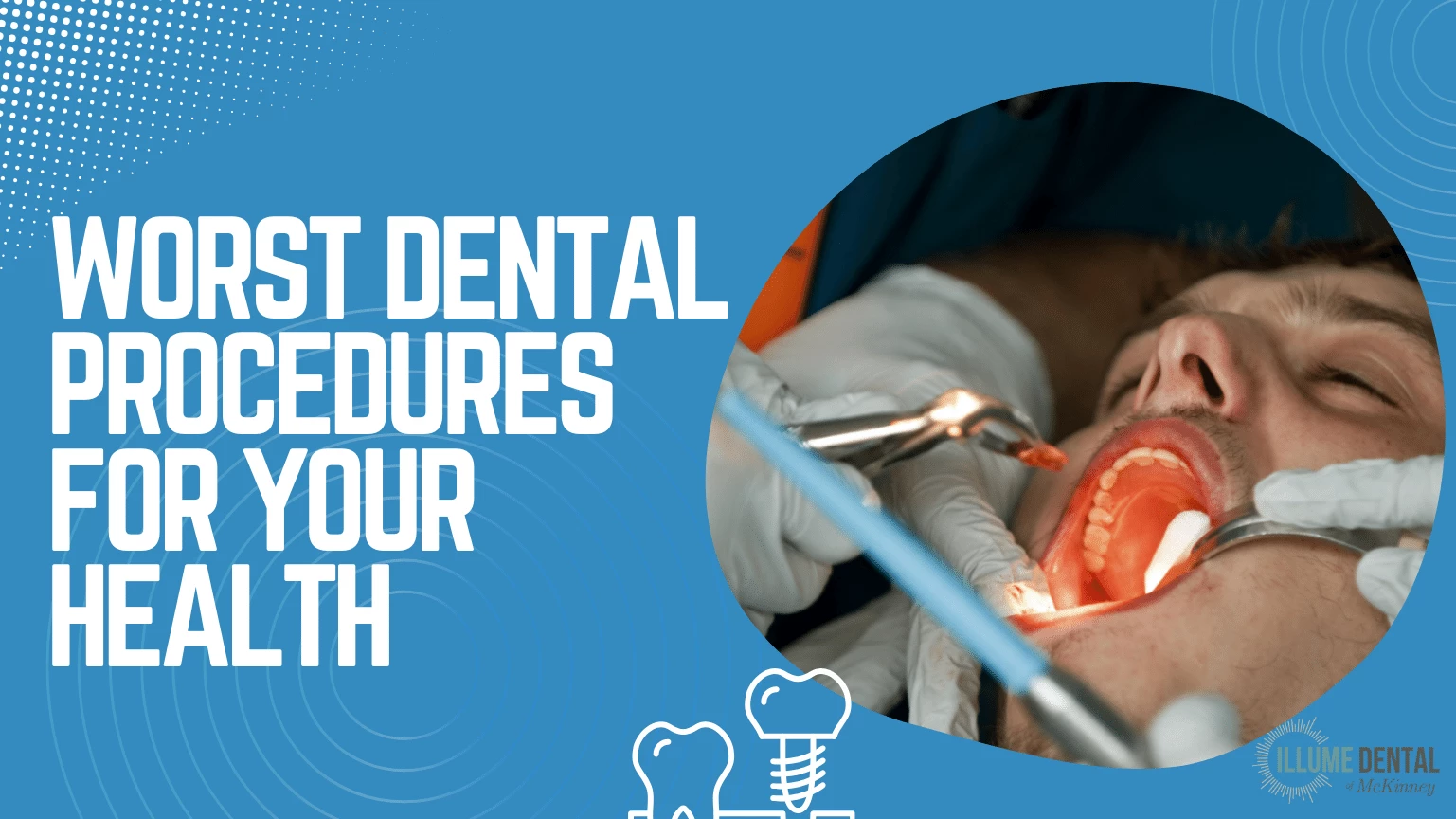 Worst Dental Procedures For Your Health