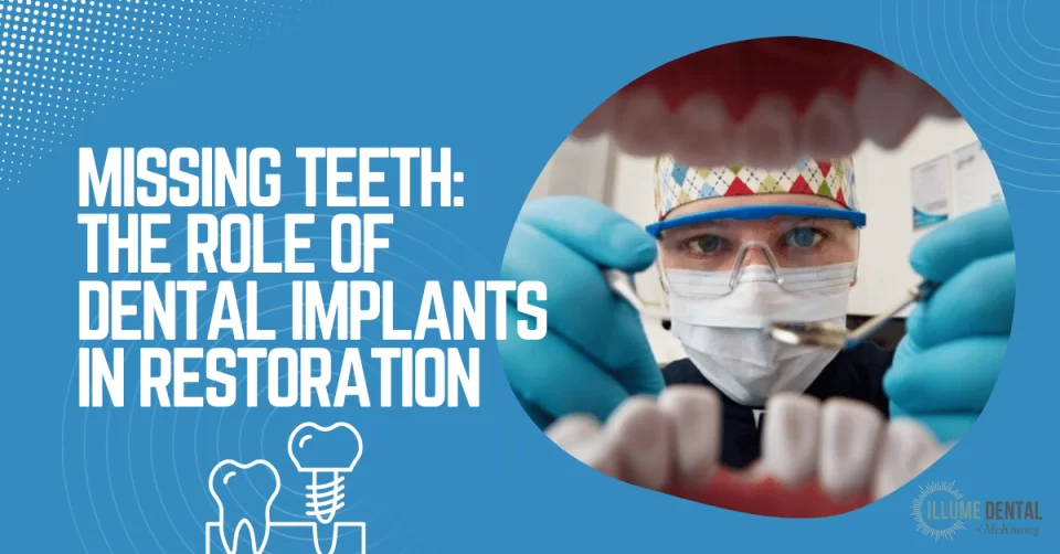 Missing Teeth: The Role of Dental Implants in Restoration