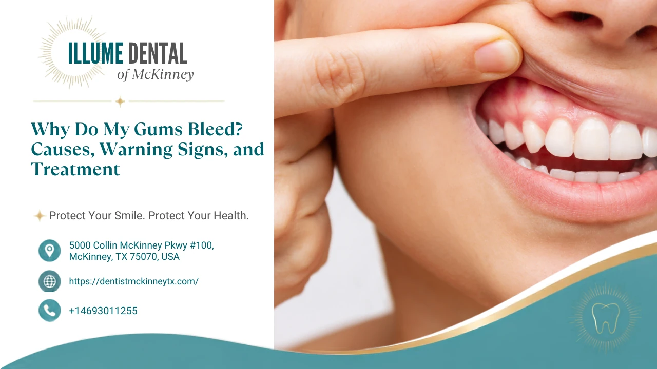Why Are My Gums Bleeding? Common Causes and When It Needs Treatment 2