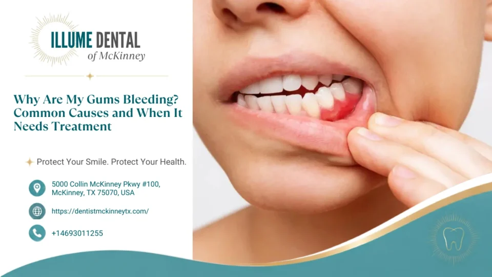 Why Are My Gums Bleeding? Common Causes and When It Needs Treatment