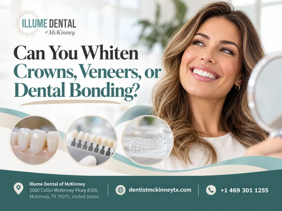 Can You Whiten Crowns, Veneers, or Dental Bonding?