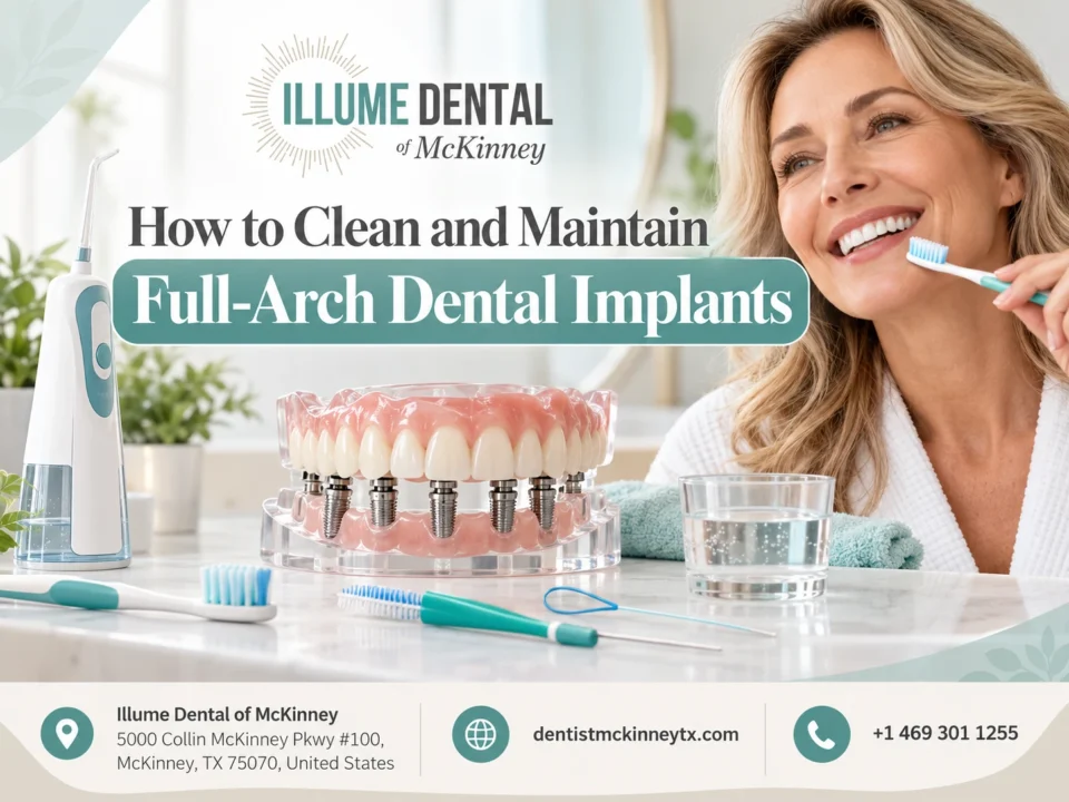 How to clean and maintain full-arch dental implants