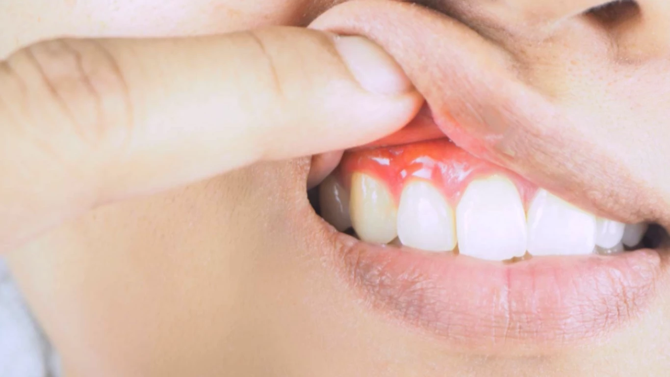 Gum Contouring Reshape Gums, Alleviate Tooth Sensitivity