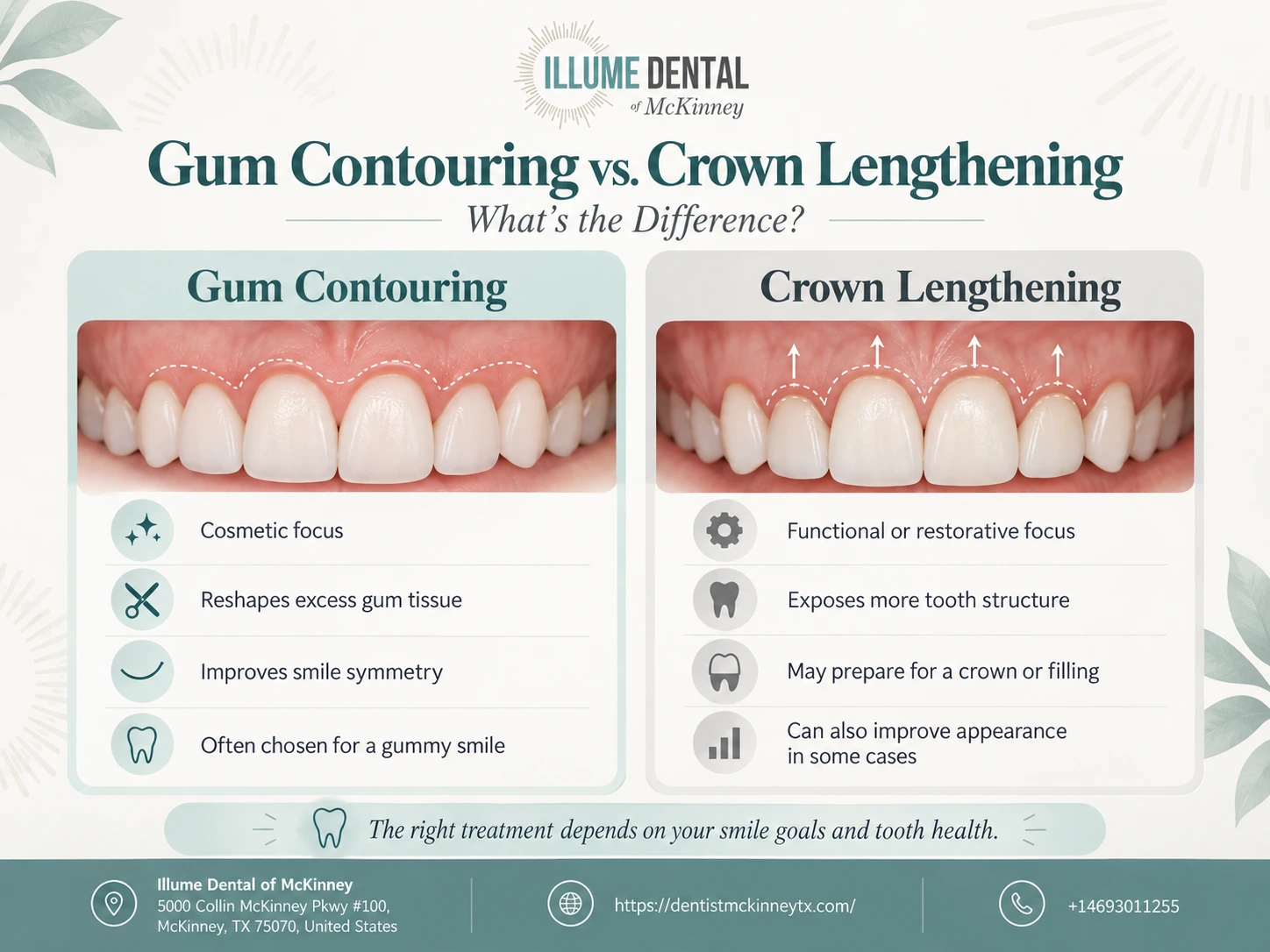Gum Contouring vs Crown Lengthening: Key Differences