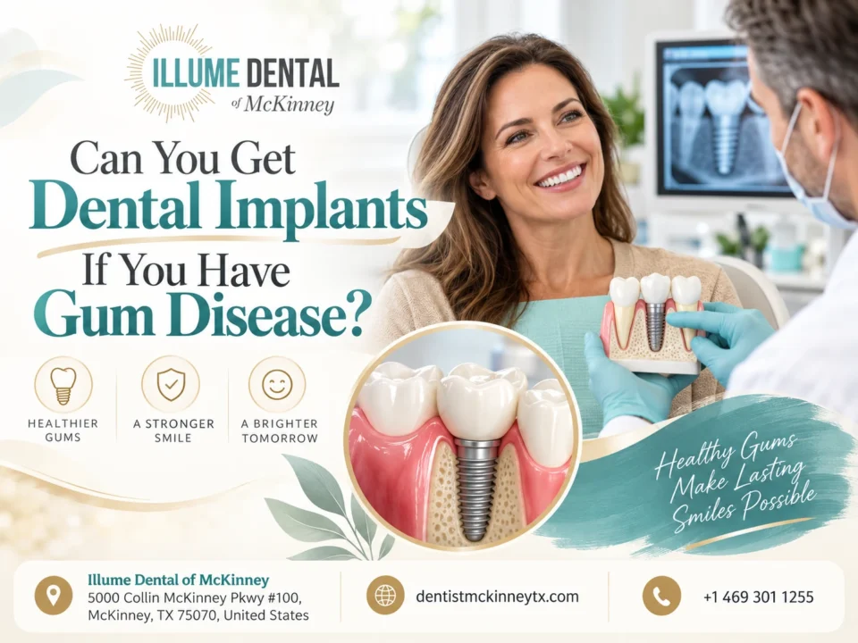 can you get dental implants if you have gum disease