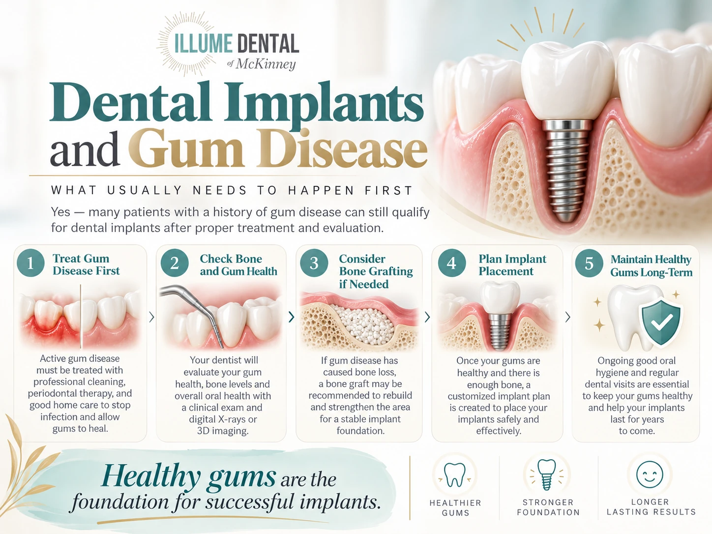 dental implants and gum disease