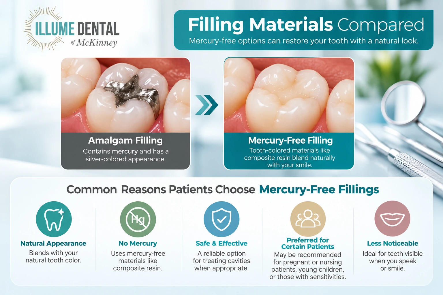 Mercury-Free Fillings in McKinney, TX 1 Mercury-Free Fillings in McKinney, TX Middle