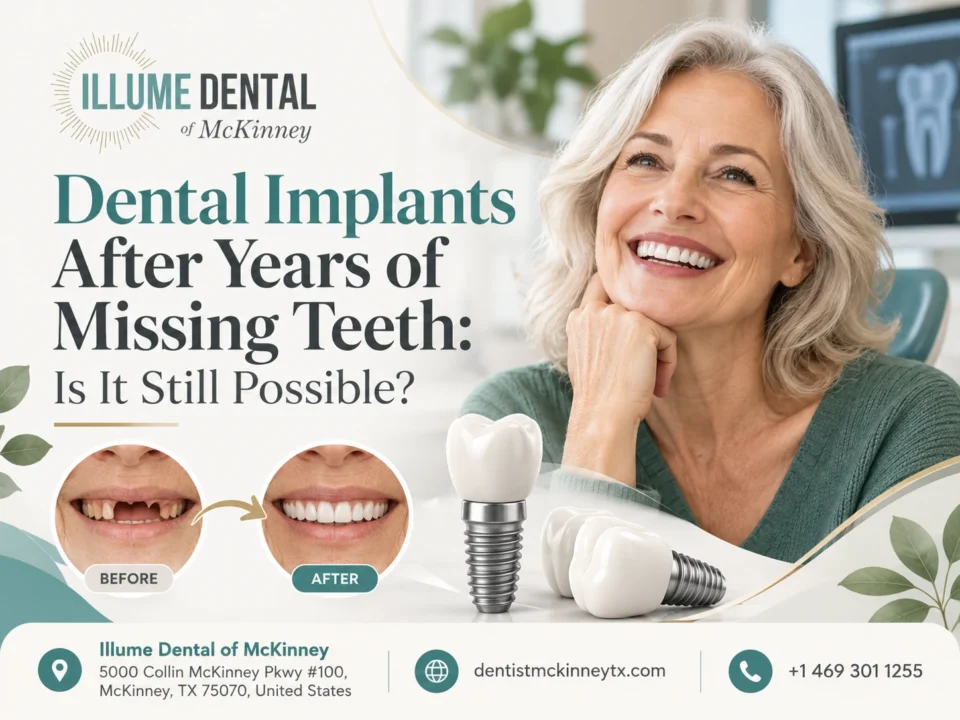 Dental Implants After Years of Missing Teeth
