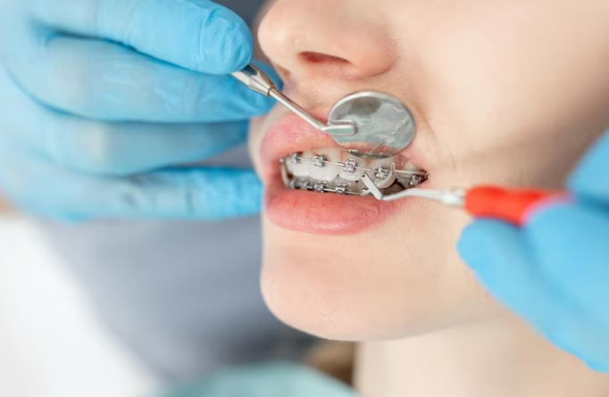 Orthodontics | Illume Dental