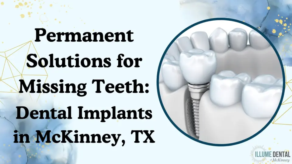Permanent Solutions for Missing Teeth Dental Implants in McKinney, TX