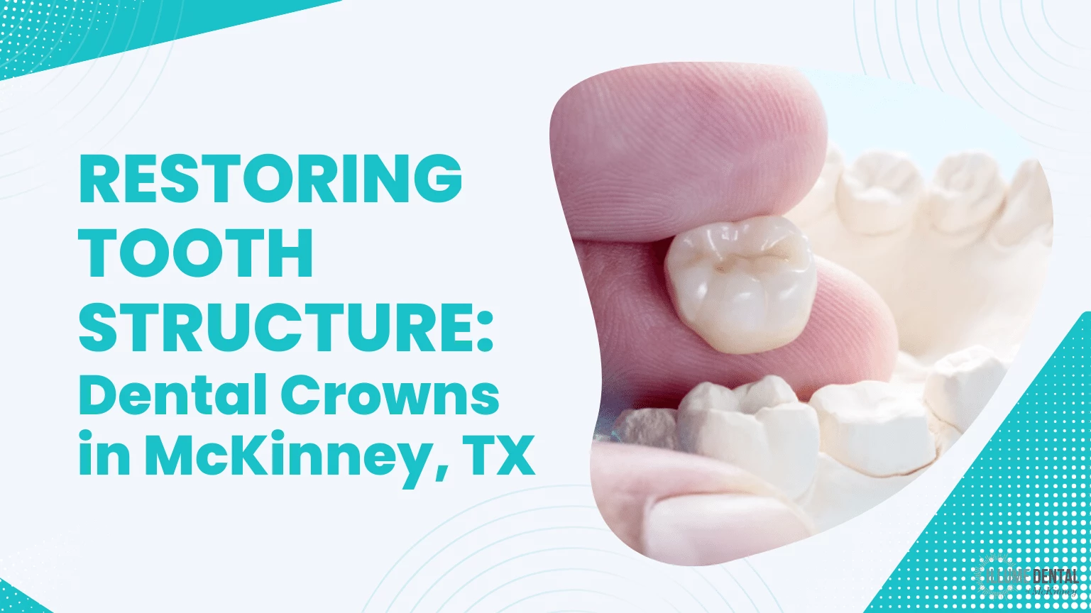 Restoring Tooth Structure Dental Crowns in McKinney, TX