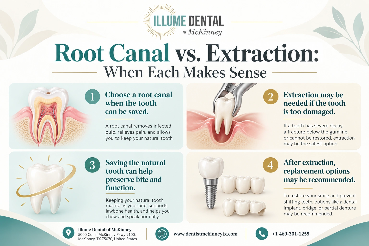 Root Canal vs. Extraction