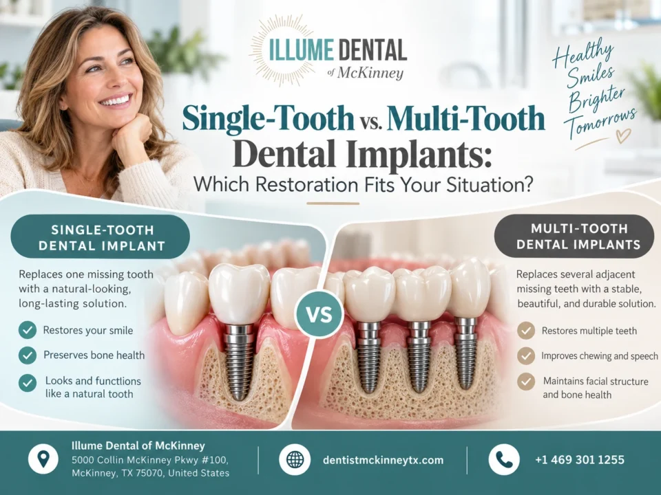 Single-Tooth vs. Multi-Tooth Dental Implants