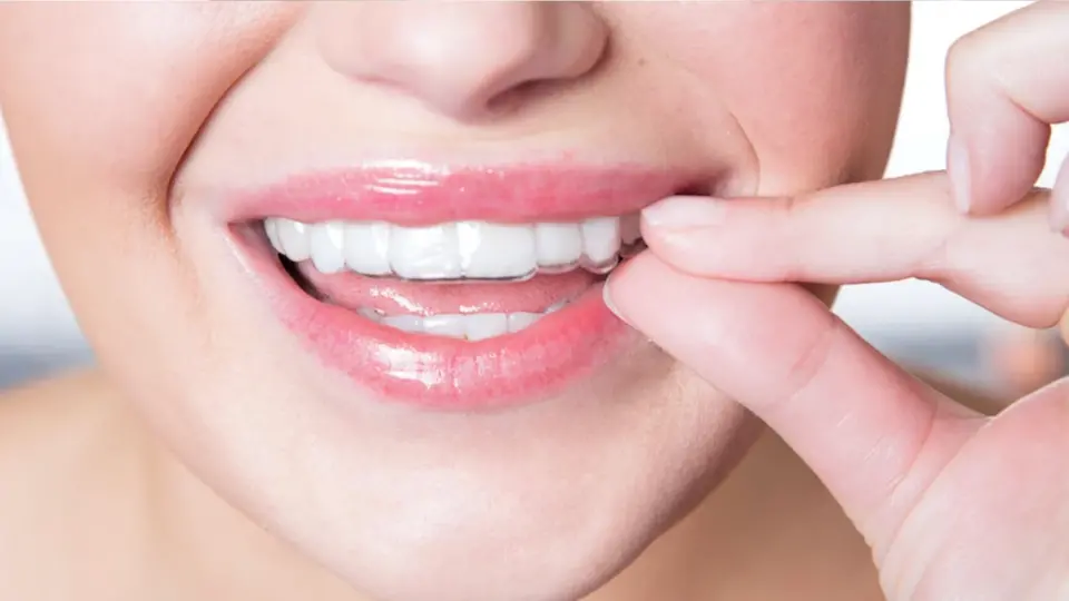 SureSmile® Clear Aligners Straighten Teeth, Eliminate Jaw Pain