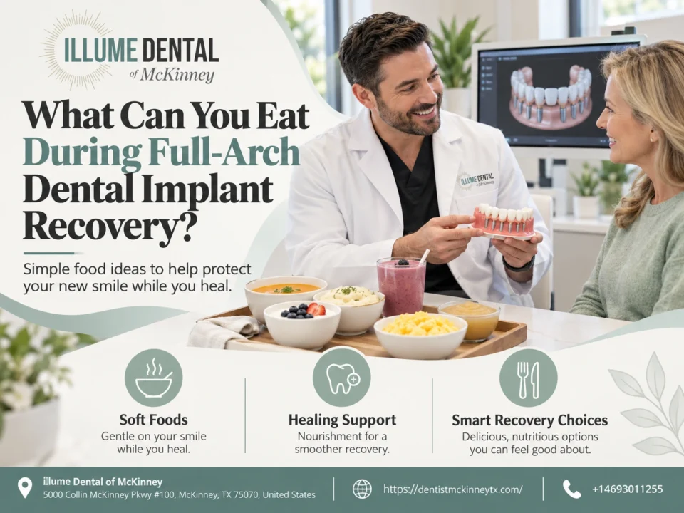 what can you eat during full-arch dental implants