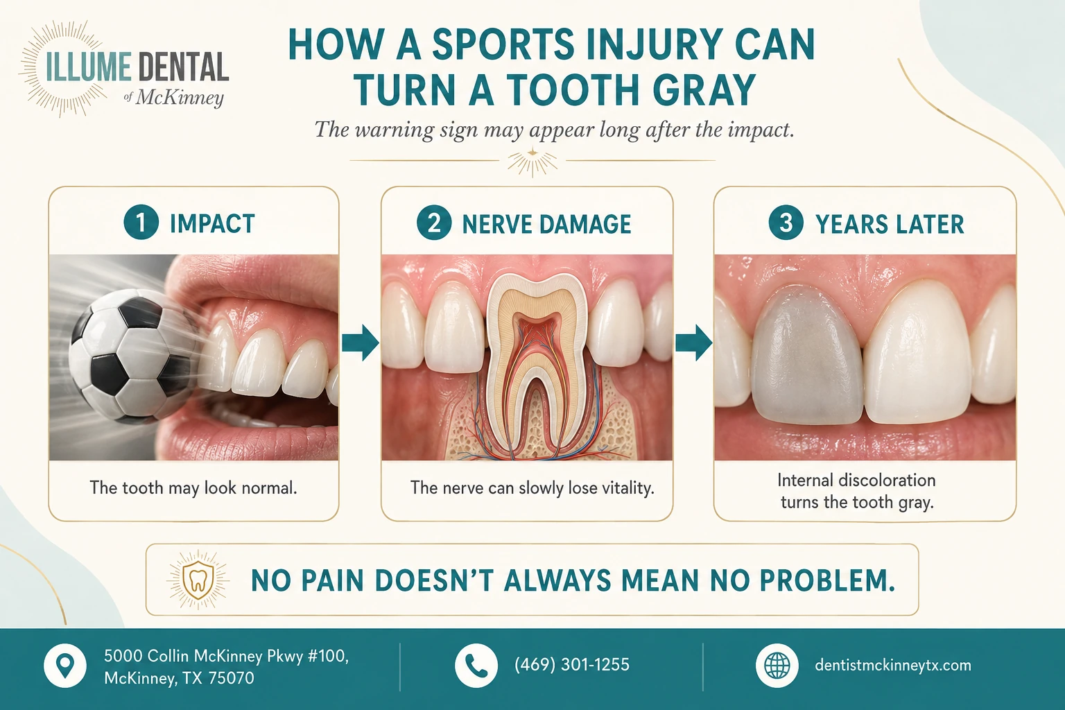 illume dental grey tooth trauma content infographic