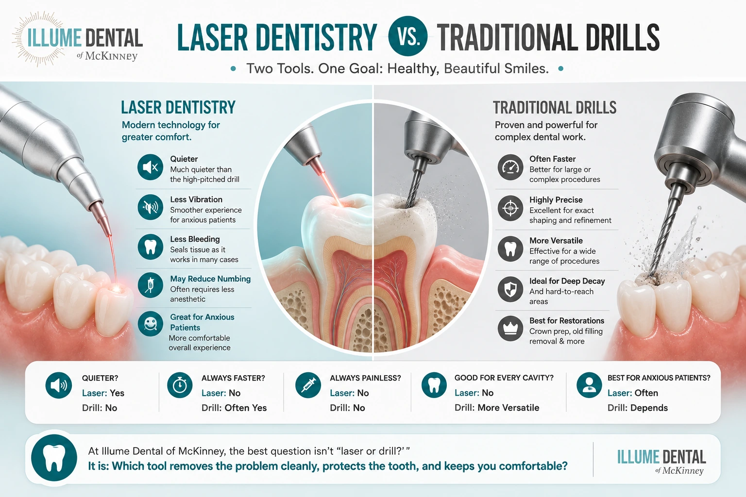 illume dental laser vs traditional drills middle content