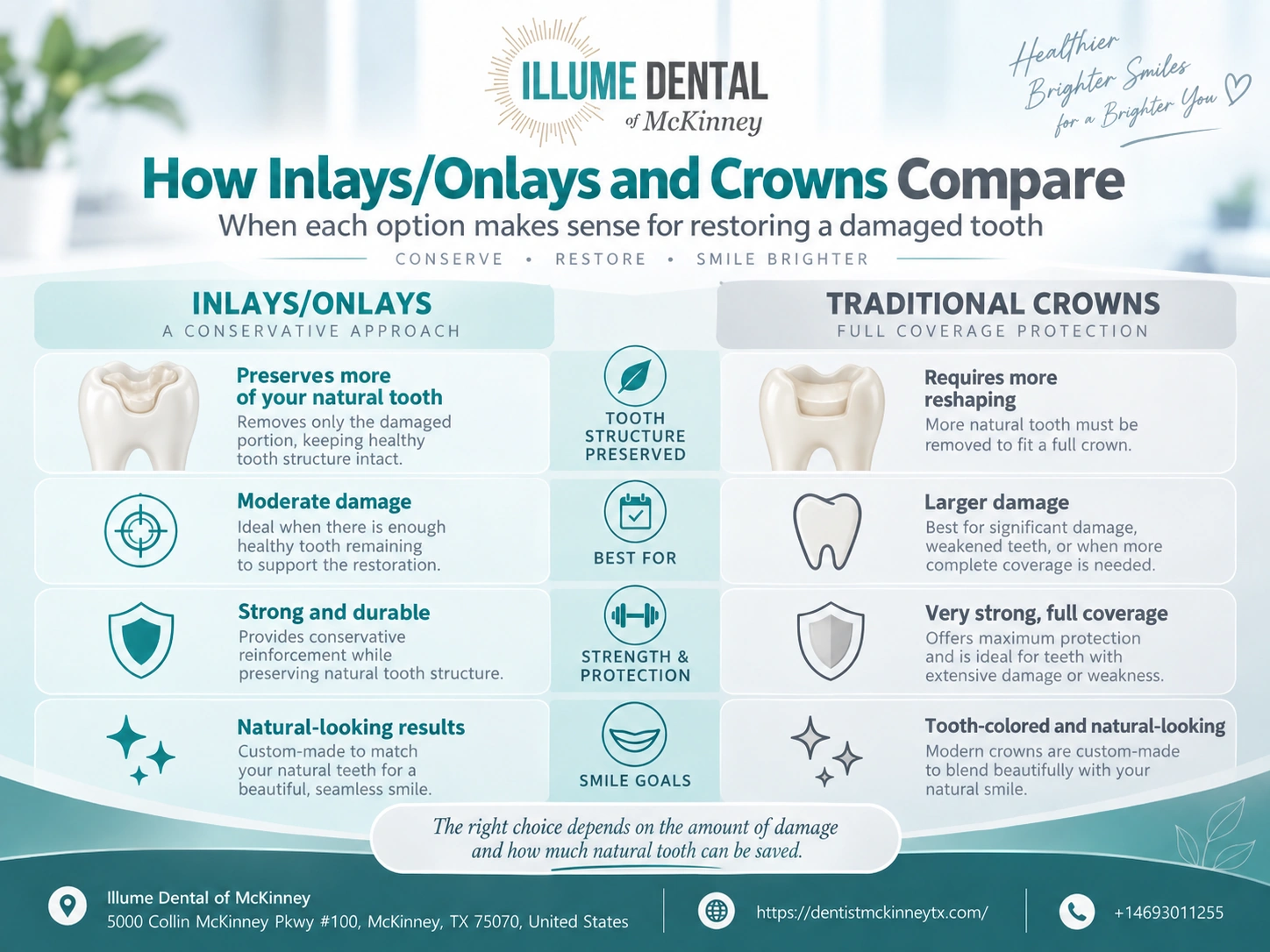 Tooth Inlays & Onlays vs. Crowns: Save Natural Teeth
