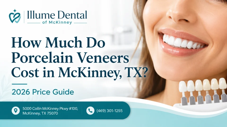 porcelain_veneers_cost_guide_in_mckinney